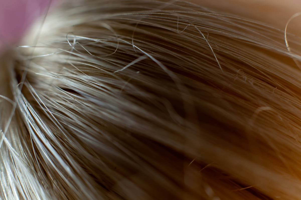 Diagram showing how shaved hair curls back into skin causing inflammation and red bumps